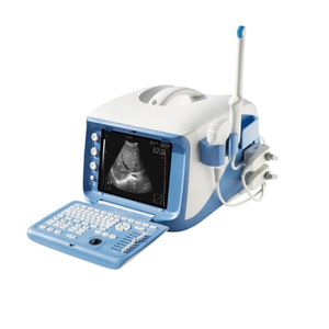 Máquina portátil del sistema de diagnóstico por ultrasonidos 4D del hospital (MT01006101)